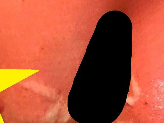 Nach Massage Tittenbesamung